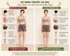  Khóa Huấn Luyện Sức Khỏe Thể Chất Doanh Nghiệp 