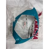  Ốp đồng hồ MXking 