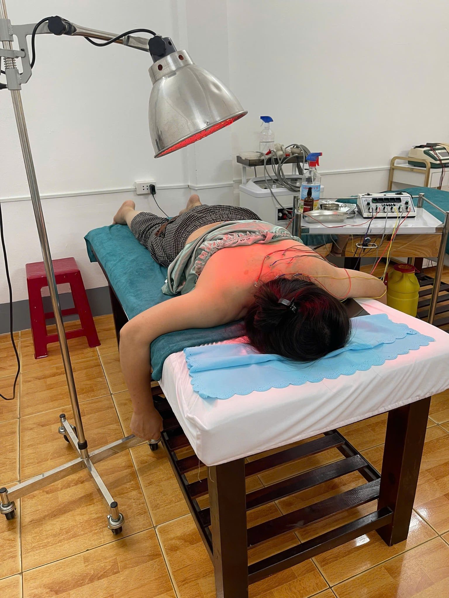  Điện Châm Trị Liệu 