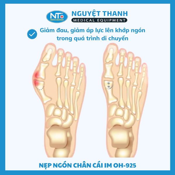 Nẹp Ngón Chân Cái I-M OH-925