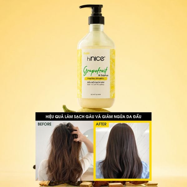 Dầu gội hiNICE sạch gàu - Dầu gội Tinh dầu Bưởi và Vỏ cây táo Ziziphus