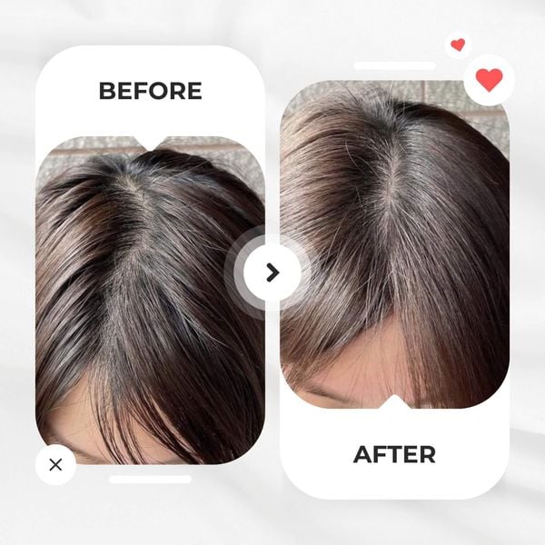 Dầu gội Tinh dầu Bưởi & Bồ kết hiNICE - Làm sạch da đầu, hỗ trợ giảm rụng tóc & kích thích mọc tóc