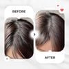 Dầu gội Tinh dầu Bưởi & Bồ kết hiNICE - Làm sạch da đầu, hỗ trợ giảm rụng tóc & kích thích mọc tóc