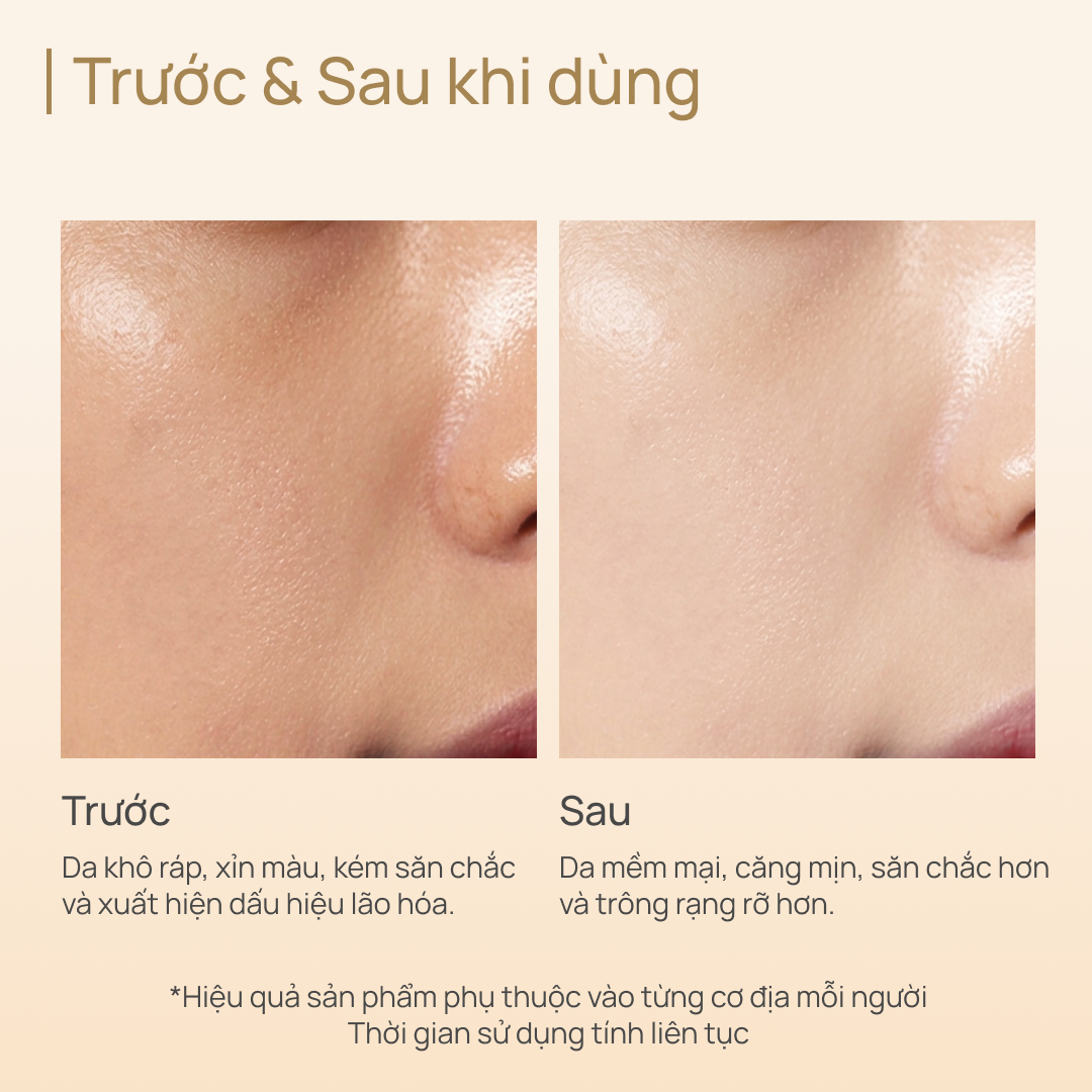 Kem Dưỡng Tăng Sinh Collagen, Phục Hồi Tổn Thương và Chống Lão Hoá Extra Collagen Cream 55g