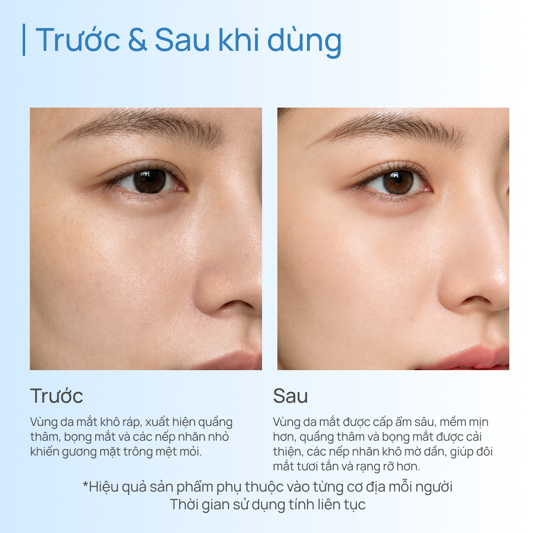 Kem Dưỡng Mắt Hỗ Trợ Cải Thiện Vùng Mắt Thâm Quầng CHANDO Himalaya 15g Chứa Niacinamide Hàng Chính Hãng