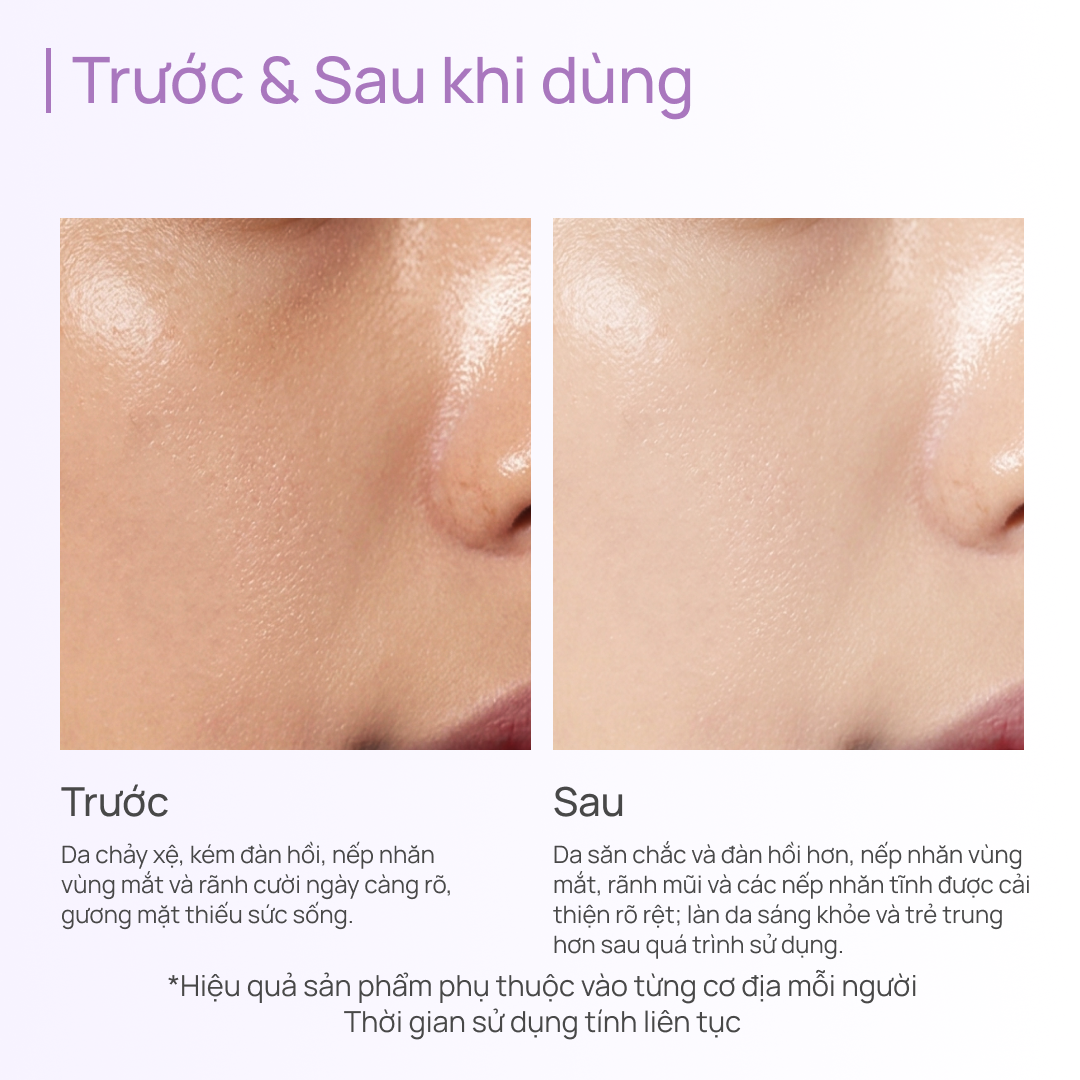 Kem Dưỡng Time Frozen Chăm Sóc Làn Da Thiếu Săn Chắc CHANDO Himalaya 50g