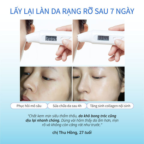 Kem Dưỡng Ẩm hỗ trợ Làm Dịu Và Dưỡng Ẩm Da Nhạy Cảm CHANDO Himalaya 55g Hàng Chính Hãng