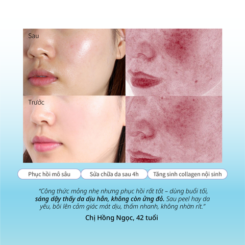 Tinh Chất Dưỡng Ẩm Dịu Nhẹ Cho Da Nhạy Cảm CHANDO Himalaya 45ml Chứa Provitamin B5 Hàng Chính Hãng