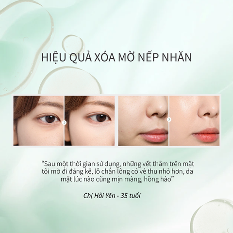 Nước Dưỡng Time Frozen Hỗ Trợ Phục Hồi Da Lão Hoá CHANDO Himalaya 160ml Hàng Chính Hãng