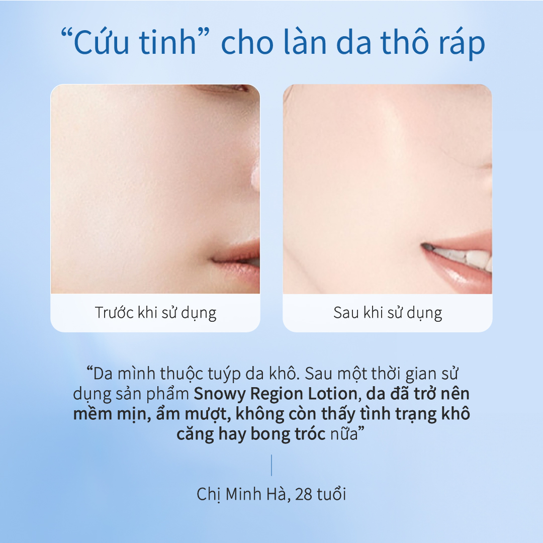 Nước Dưỡng Ẩm Vùng Băng Tuyết CHANDO Himalaya 160ml Chứa Niacinamide Hàng Chính Hãng