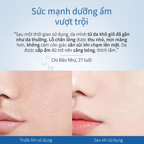 Tinh Chất Hỗ Trợ Dưỡng Ẩm Vùng Băng Tuyết CHANDO Himalaya 40ml Chứa Rau Má Hàng Chính Hãng