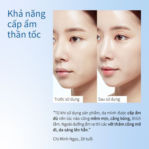 Kem Dưỡng Ẩm Hỗ Trợ Làm Dịu và Phục Hồi Da, Chứa Rau Má Centella Snowy Region - Chính hãng CHANDO Himalaya 50g