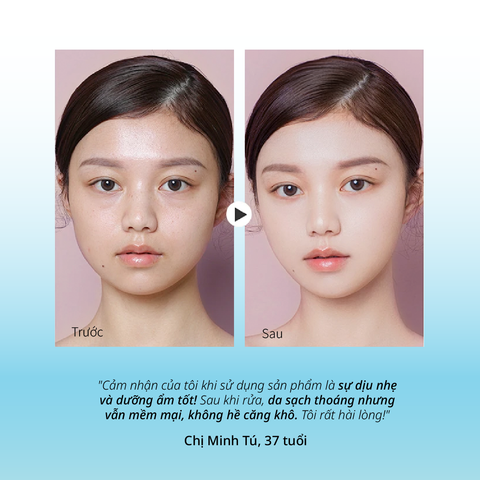 Sữa Rửa Mặt Dịu Nhẹ Cho Da Nhạy Cảm CHANDO Himalaya 150ml Chứa Vitamin B5 Hàng Chính Hãng
