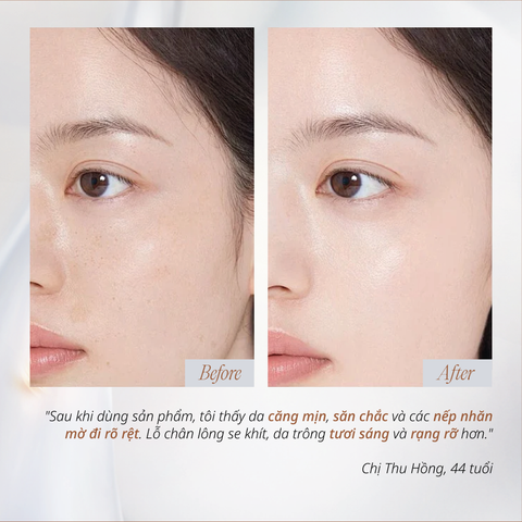 Tinh Chất Hỗ Trợ Tăng Sinh Collagen Và Cải Thiện Da Lão Hóa, Nhạy Cảm 50ml CHANDO Himalaya Chính Hãng