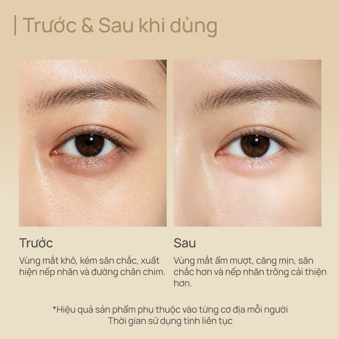 Kem Dưỡng Mắt Chống Lão Hóa, Làm Săn Chắc & Giảm Nếp Nhăn CHANDO Gold Diamond Multi Anti-aging Eye Cream 20g