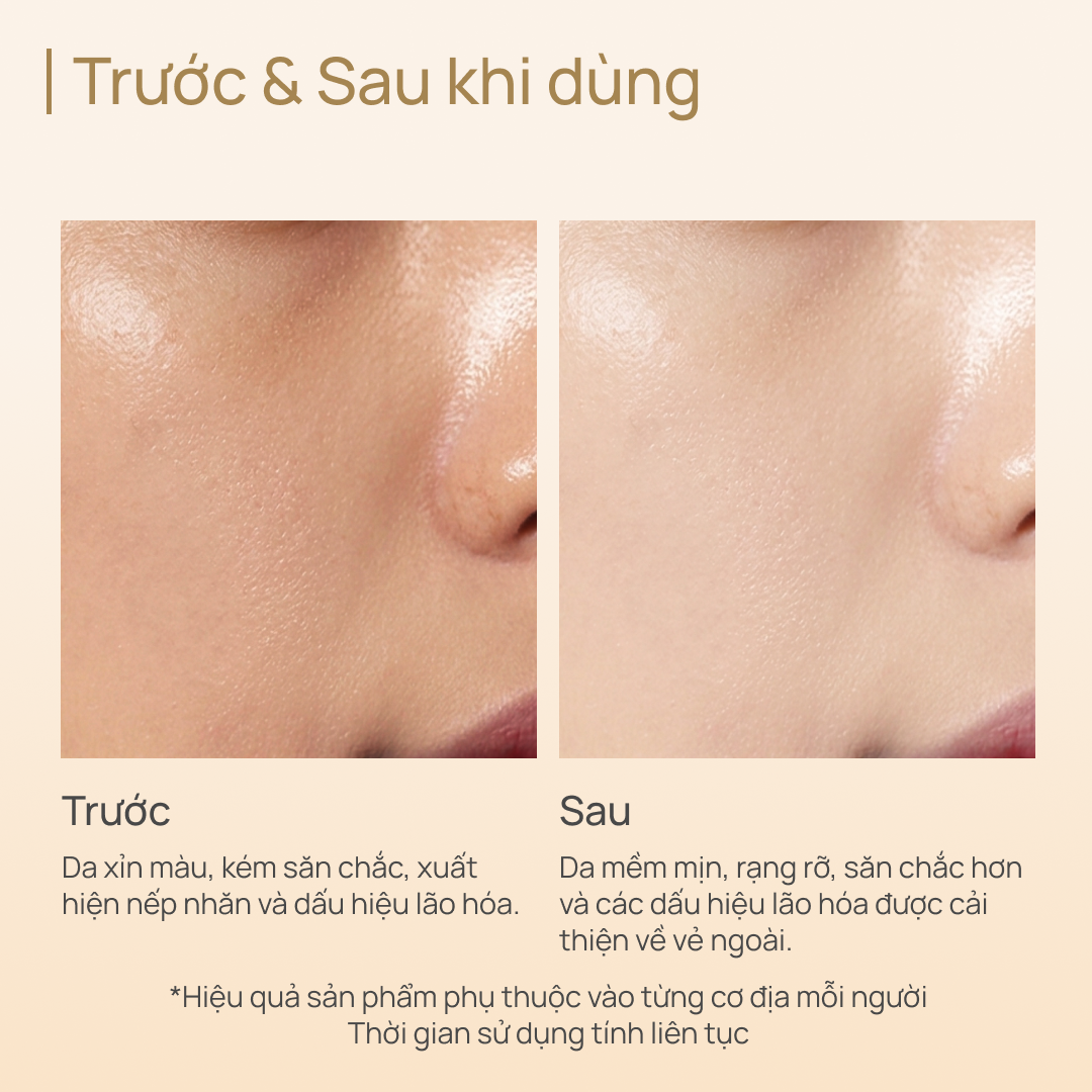 Sữa Dưỡng Tăng Sinh Collagen, Phục Hồi Tổn Thương và Chống Lão Hoá CHANDO Extra Collagen Emulsion 110ml
