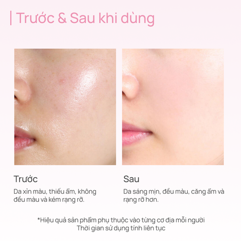 Mặt Nạ Thảo Dược Dưỡng Trắng CHANDO Gentiana Brightening Mask 5 MIẾNG