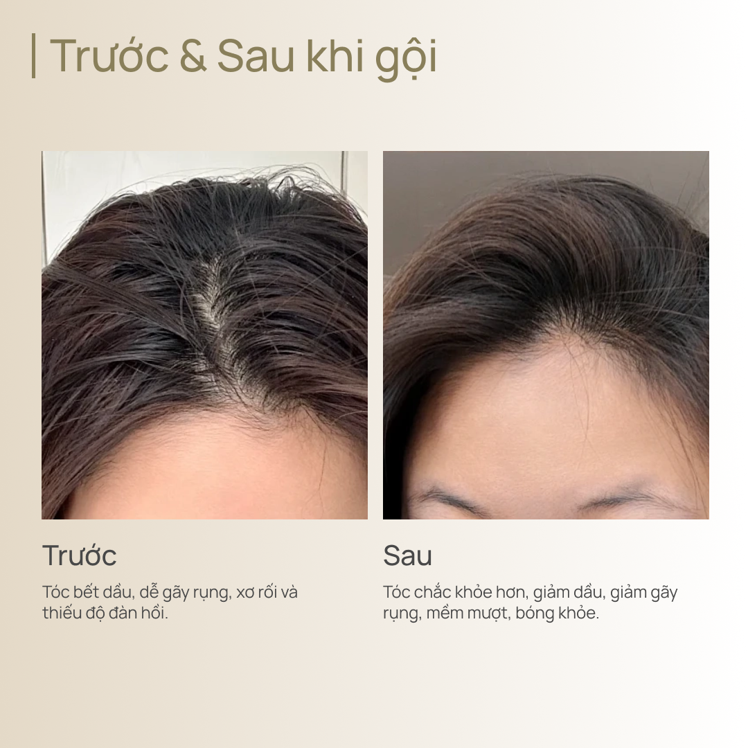 Dầu Xả Hỗ Trợ Ngăn Ngừa Gãy Rụng & Kiểm Soát Dầu CHANDO Himalaya 600g Hàng Chính Hãng