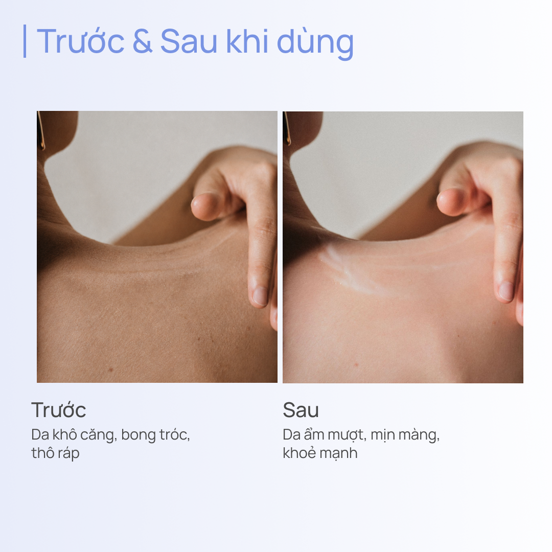 Sữa Dưỡng Thể Hỗ Trợ Dưỡng Ẩm 600g CHANDO Himalaya Hàng Chính Hãng