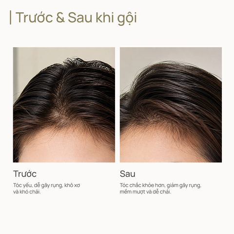 Dầu Gội Ngăn Ngừa Rụng Tóc & Nuôi Dưỡng Tóc Chắc Khỏe CHANDO Anti-Hairloss & Strengthening Shampoo 600ml