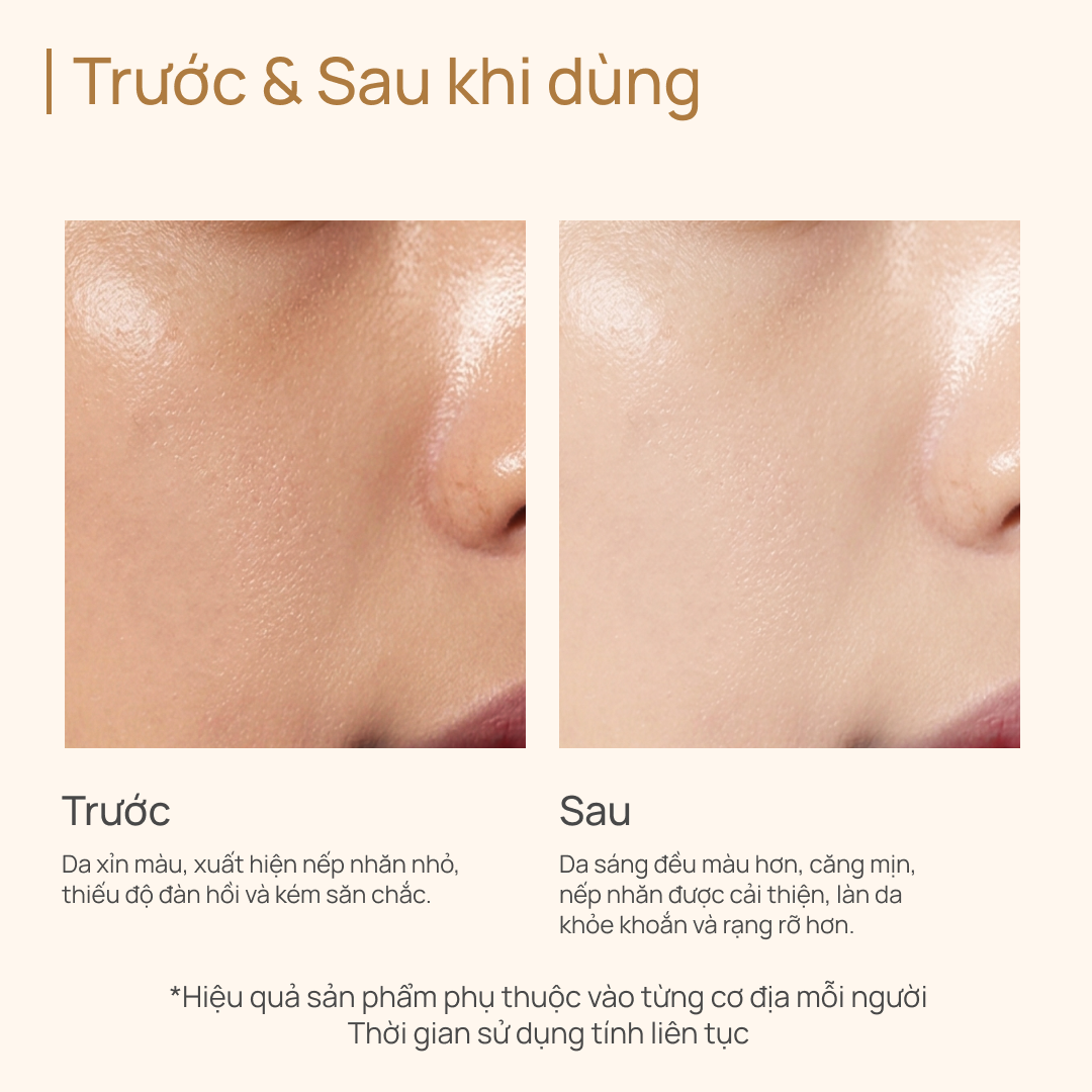 Kem Hỗ Trợ Dưỡng Trắng và Cải Thiện Da Kém Săn Chắc 18g  CHANDO Himalaya Chính Hãng