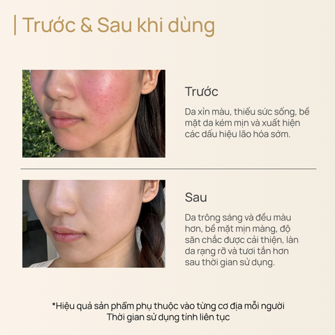 Nước thần Chống Lão Hóa, Làm Săn Chắc & Làm Sáng CHANDO Himalaya Essence 110ml