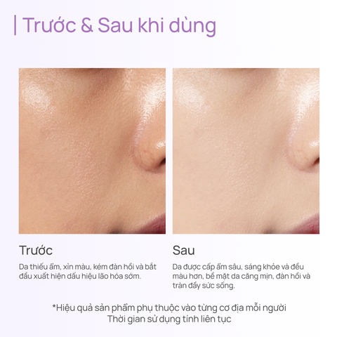 Toner Chống Lão Hoá, Giảm Xỉn Màu, Mờ Quầng Thâm CHANDO Time Frozen Aging Resistance 160ml