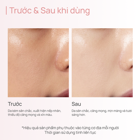 Kem Dưỡng Giảm Chảy Xệ, Săn Chắc Da, Mờ Rãnh Cười CHANDO Pink Diamond Firming Delicate Rose Cream 55g