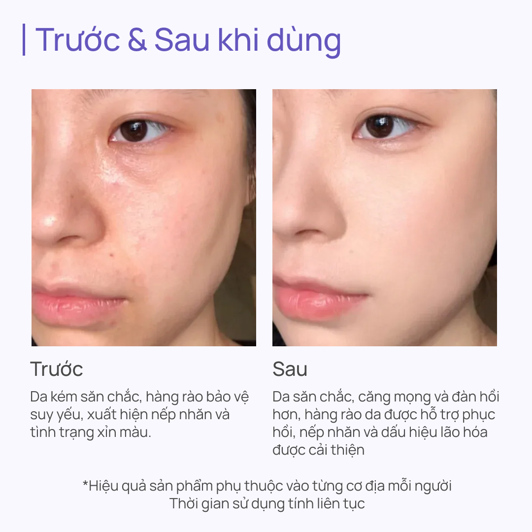 Kem Dưỡng Giúp Phục Hồi Da Lão Hóa Toàn Năng CHANDO Himalaya 55g Hàng Chính Hãng