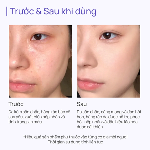 Kem Dưỡng Giúp Phục Hồi Da Lão Hóa Toàn Năng CHANDO Himalaya 55g Hàng Chính Hãng