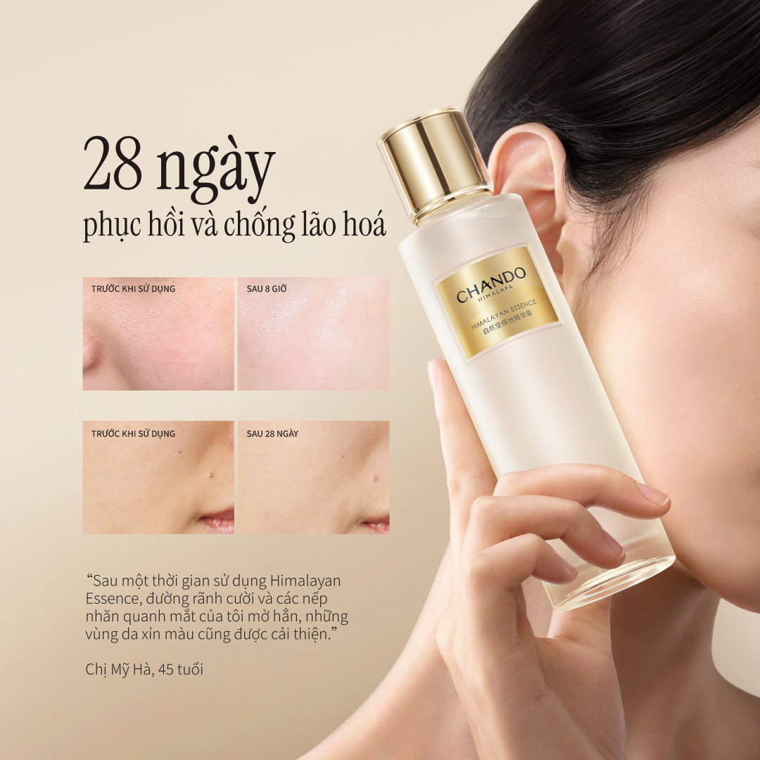 Nước Thần Men Tuyết Sơn CHANDO Himalaya 110ml Giúp Phục Hồi Da Lão Hóa Hàng Chính Hãng