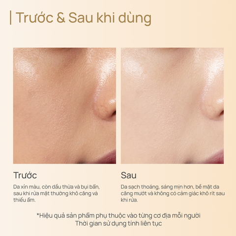 Sữa Rửa Mặt Dưỡng Sáng, Mờ Thâm Và Chống Lão Hoá CHANDO CellCrystal Whitening Moisturizing Cleanser 120g