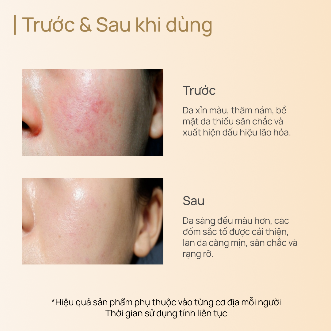 Kem Dưỡng Trắng, Mờ Thâm, Mờ Nám Sạm & Chống Lão Hóa CHANDO CellCrystal Whitening Radiance Rejuvenating Cream 55g