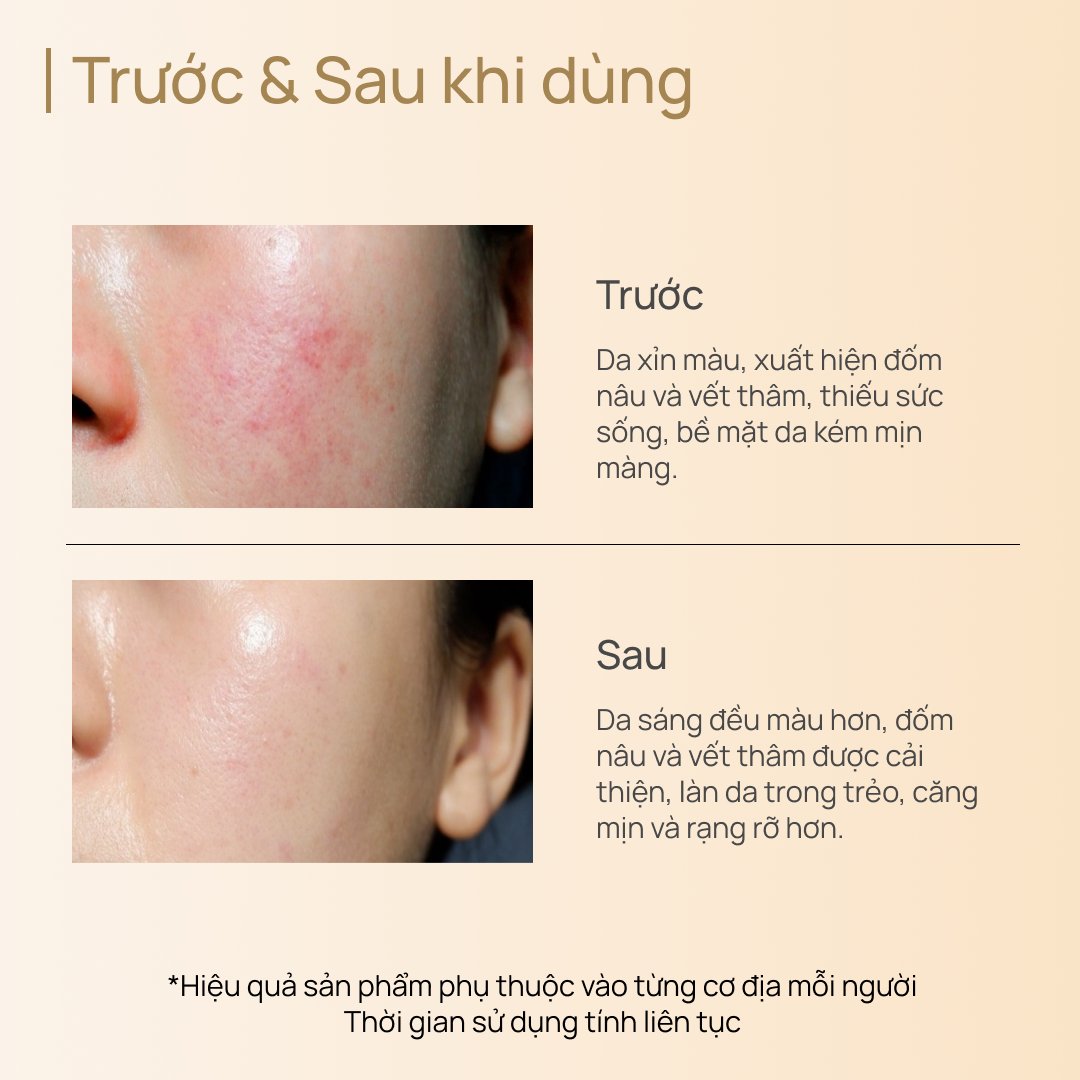 Tinh Chất Dưỡng Sáng, Cải Thiện Nám Sạm & Chống Lão Hóa CHANDO CellCrystal Whitening Radiance Rejuvenating 40ml