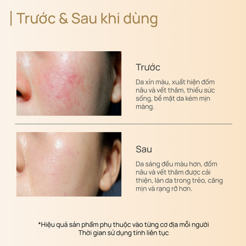 Tinh Chất Dưỡng Sáng, Cải Thiện Nám Sạm & Chống Lão Hóa CHANDO CellCrystal Whitening Radiance Rejuvenating 40ml