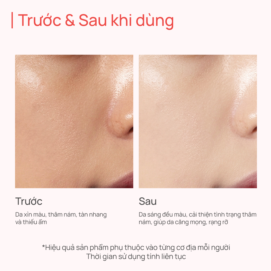 Kem Dưỡng ẩm, Dưỡng sáng, Hỗ trợ mờ thâm nám CHANDO Crystal White 50g