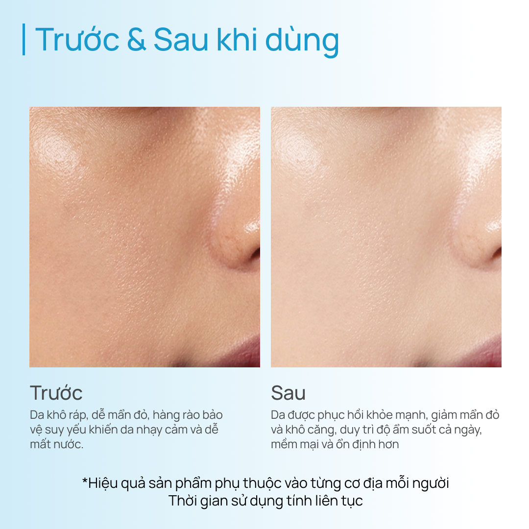 Kem Dưỡng Ẩm, Làm Dịu, Phục Hồi Da CHANDO Soothing Moisturizing 55g