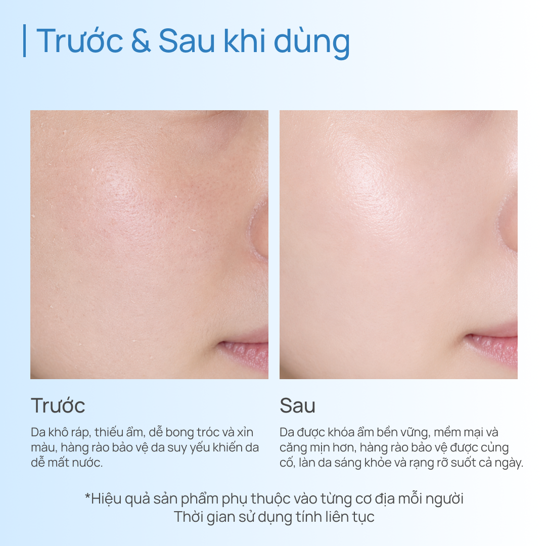 Kem Dưỡng Ẩm & Phục Hồi CHANDO Snowy Region Cream 50g