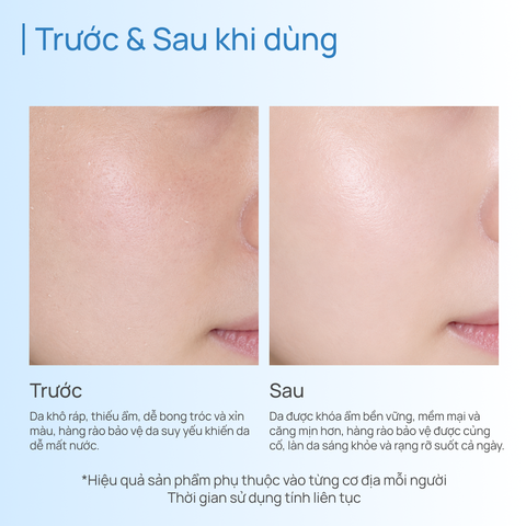 Kem Dưỡng Ẩm & Phục Hồi CHANDO Snowy Region Cream 50g