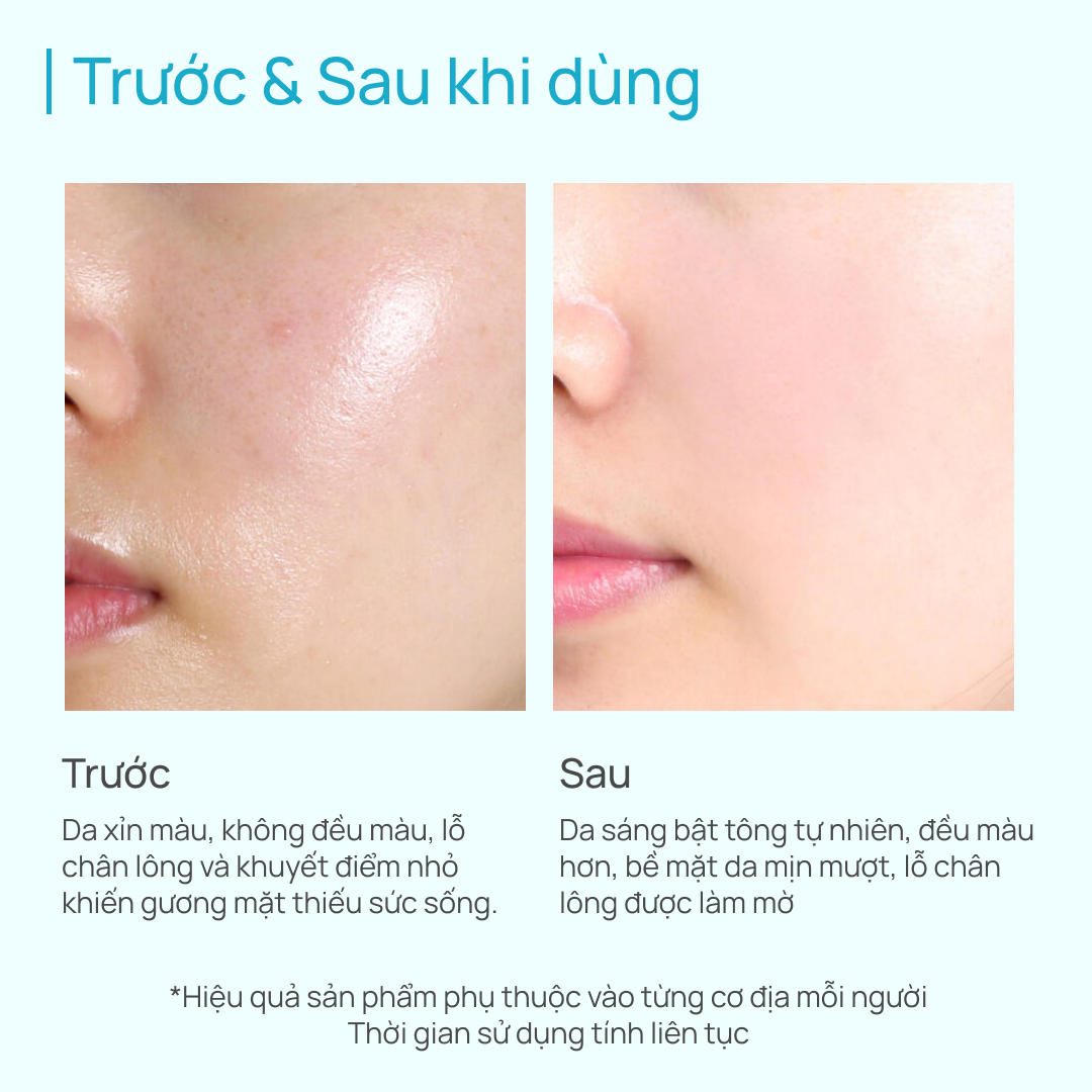 Kem Dưỡng Nâng Tone Hỗ Trợ Dưỡng Sáng Da SPF20/PA++ CHANDO Himalaya 50G