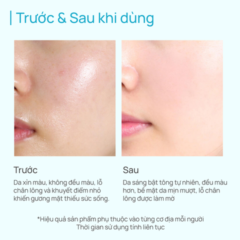 Kem Dưỡng Nâng Tone Hỗ Trợ Dưỡng Sáng Da SPF20/PA++ CHANDO Himalaya 50G