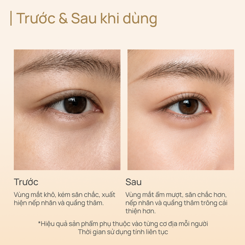 Kem Dưỡng Mắt Tăng Sinh Collagen, Phục Hồi Tổn Thương và Chống Lão Hoá Extra Collagen Eye Cream 15g