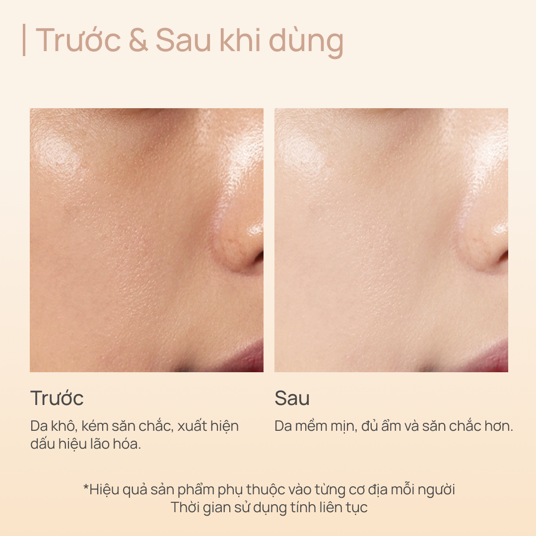 Toner Tăng Sinh Collagen, Phục Hồi Tổn Thương và Chống Lão Hoá CHANDO Extra Collagen 200ml