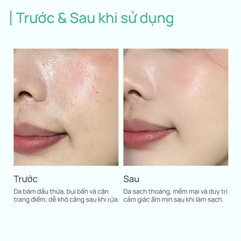 Kem Làm Sạch Cấp Ẩm Tinh Chất Suối Khoáng CHANDO Himalaya 125g Hàng Chính Hãng