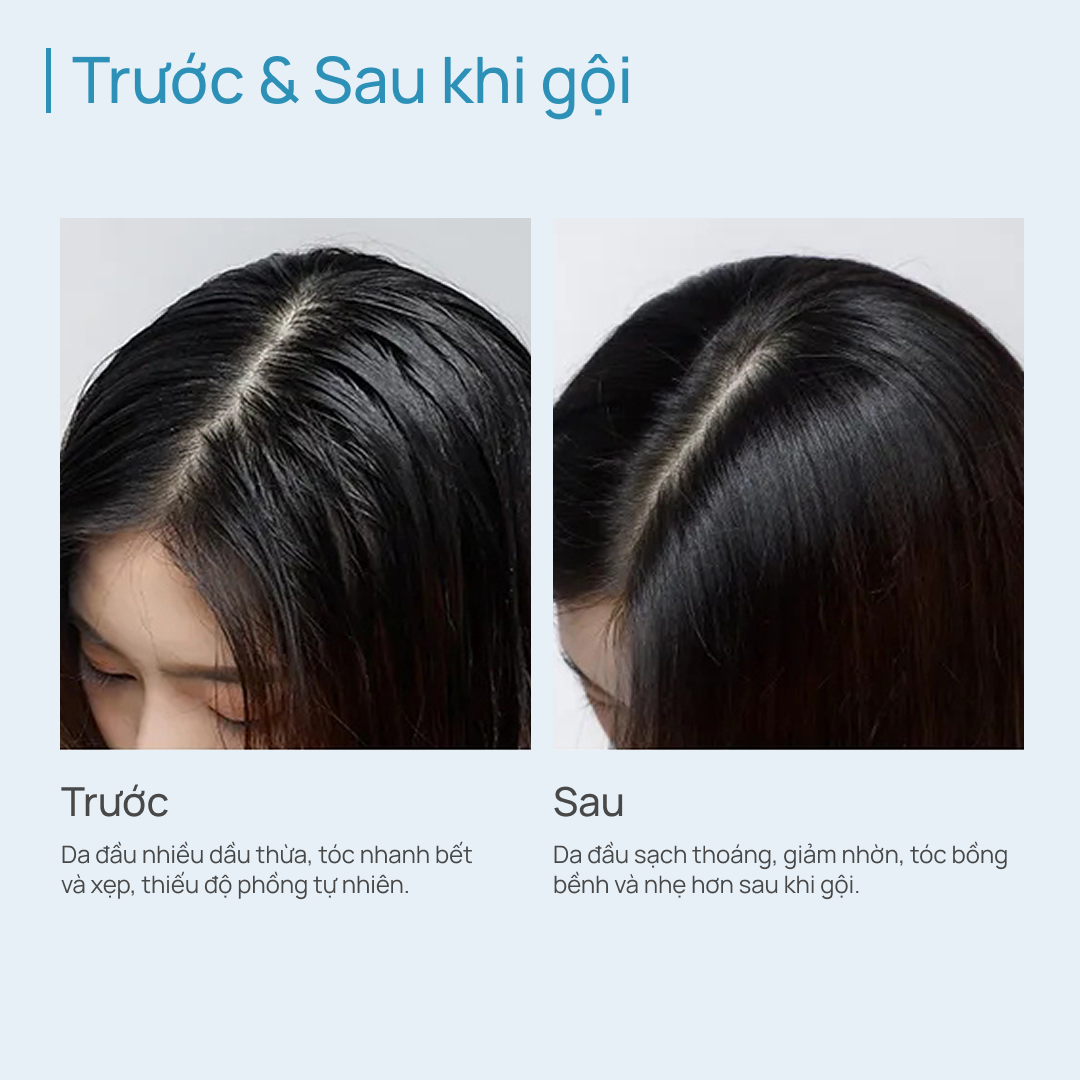 Dầu Gội Kiểm Soát Dầu & Làm Phồng Tóc CHANDO Oil Control & Volumizing Shampoo 600ml