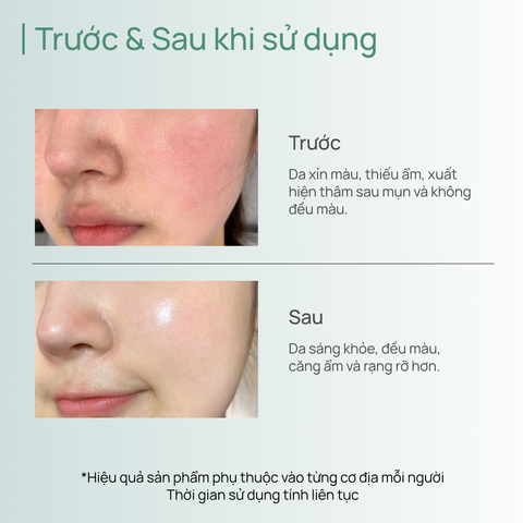Mặt Nạ Pro-Vitamin B5 Dịu Da CHANDO Panthenol Soothing Mask 5 MIẾNG