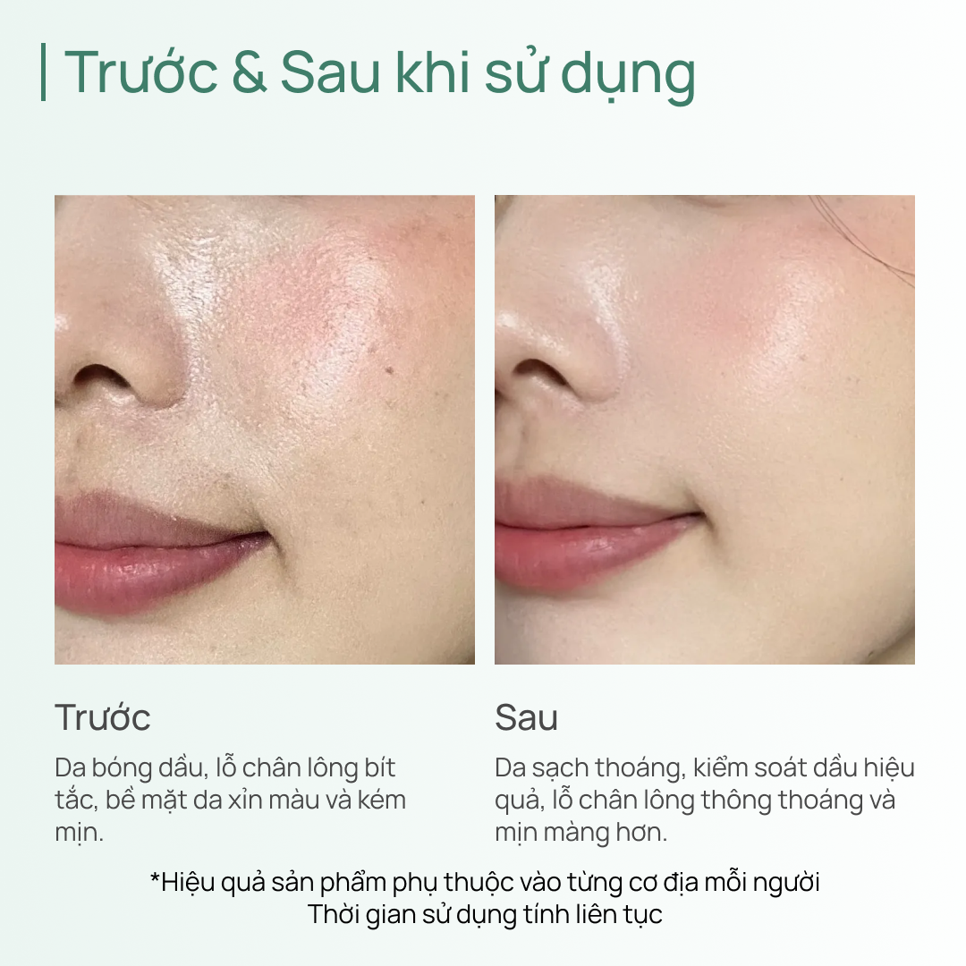 Mặt Nạ Đất Sét Trà Xanh Giảm Mụn Đầu Đen, Kiềm dầu CHANDO 100g