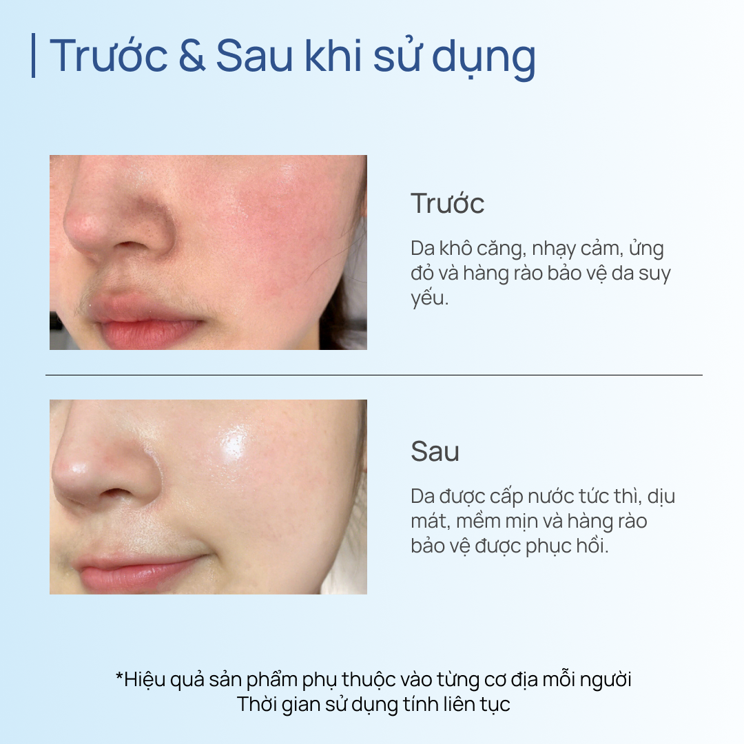 Mặt Nạ Lợi Khuẩn Phục Hồi CHANDO Moisturizing Repair Mask 5 MIẾNG
