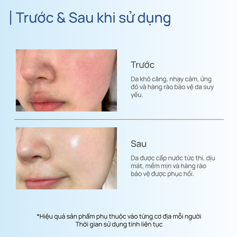 Mặt Nạ Lợi Khuẩn Phục Hồi CHANDO Moisturizing Repair Mask 5 MIẾNG