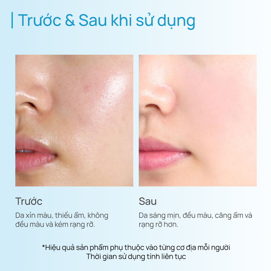 Mặt Nạ Tinh Chất CHANDO ESSENCE MASK (NHIỀU PHÂN LOẠI)